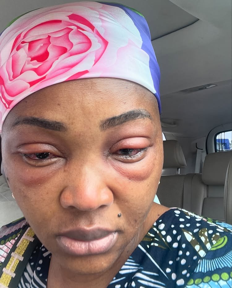 Mercy Aigbe Reveals Health Battle During 'Thinline' Filming: Swollen Eyes, Hospitalization, and Emotional Struggles 