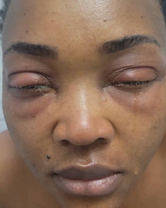Mercy Aigbe Reveals Health Battle During 'Thinline' Filming: Swollen Eyes, Hospitalization, and Emotional Struggles 