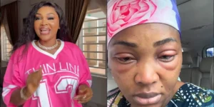 Mercy Aigbe Reveals Health Battle During 'Thinline' Filming: Swollen Eyes, Hospitalization, and Emotional Struggles